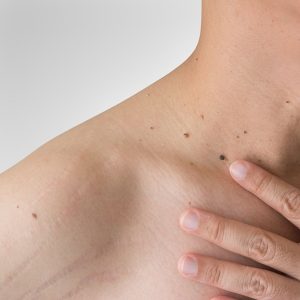Dermatología